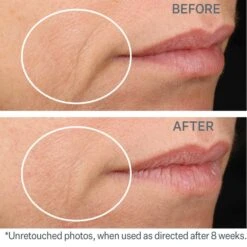 StriVectin AR™AR Advanced Concentrated Serum -Estee Lauder Sales Store 11091238 8214673623776075