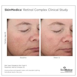 SkinMedica Retinol Complex 1.0 -Estee Lauder Sales Store 11289678 2124410181165551