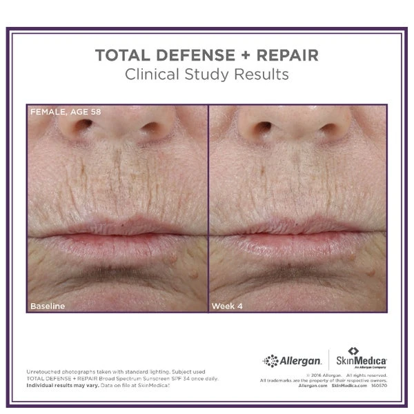 SkinMedica Total Defense And Repair SPF 34 3 SkinMedica Total Defense And Repair SPF 34 - Image 3