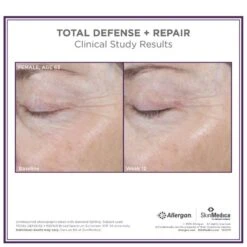 SkinMedica Total Defense And Repair SPF 34 - Tinted 7 SkinMedica Total Defense And Repair SPF 34 - Tinted -Estee Lauder Sales Store 11289688 9034410181162302