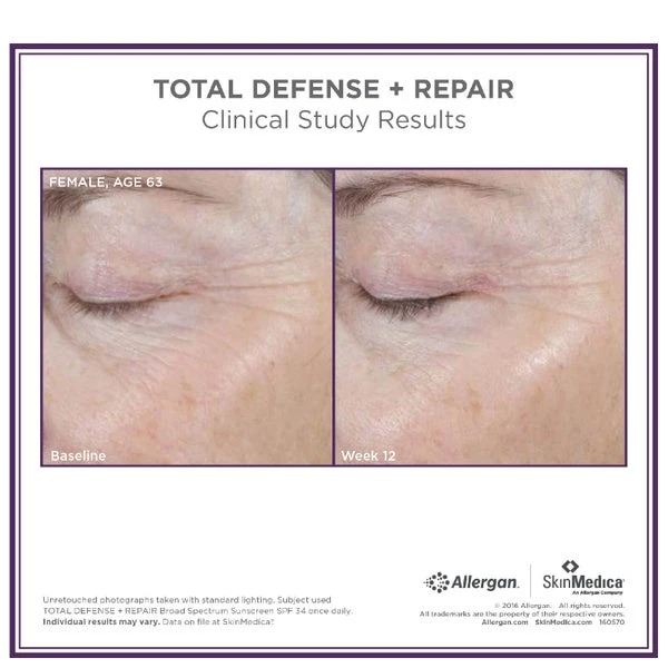 SkinMedica Total Defense And Repair SPF 34 - Tinted 4 SkinMedica Total Defense And Repair SPF 34 - Tinted - Image 4