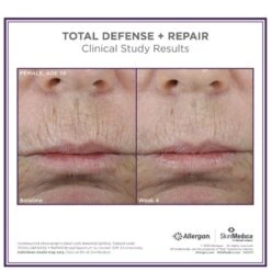 SkinMedica Total Defense And Repair SPF 34 - Tinted 6 SkinMedica Total Defense And Repair SPF 34 - Tinted -Estee Lauder Sales Store 11289688 9454410181113114