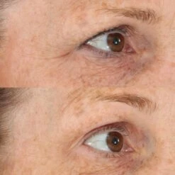 Perricone MD Essential Fx Acyl-Glutathione: Eyelid Lift Serum -Estee Lauder Sales Store 11833577 1865021901283950