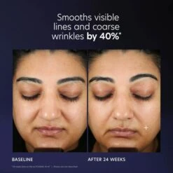 PCA SKIN Pro-Max Age Renewal Advanced Anti-Aging Serum With Micro Growth Factor Technology 1 Oz -Estee Lauder Sales Store 14766916 1635062515857094